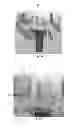 Fig. 04 - Tools for customized design of dental restorations