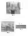 Fig. 06 - Tools for customized design of dental restorations