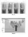 Fig. 07 - Tools for customized design of dental restorations