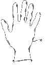 Fig. 01 - Surgical glove with ergonomic features