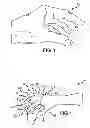 Fig. 03 - Surgical glove with ergonomic features