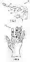 Fig. 04 - Surgical glove with ergonomic features