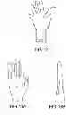 Fig. 08 - Surgical glove with ergonomic features