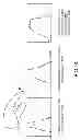 Fig. 09 - Surgical glove with ergonomic features