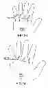 Fig. 16 - Surgical glove with ergonomic features