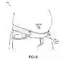 Fig. 07 - ADJUSTABLE MATERNITY PANT EXPANDER