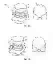 Fig. 02 - Pad with internal chamber and opening mechanism