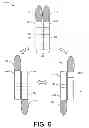 Fig. 07 - Split-tip applicator