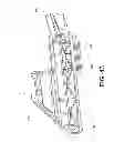 Fig. 41 - Saw assembly with bevel gear drivetrain