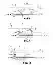 Fig. 05 - Venetian type blind operator