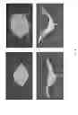 Fig. 09 - Systems and methods for actuating soft robotic actuators