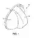 Fig. 02 - Accessory for indicating status of stove burner