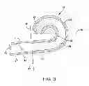 Fig. 04 - Accessory for indicating status of stove burner