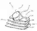 Fig. 01 - Motorcycle ignition coil assembly