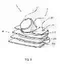 Fig. 02 - Motorcycle ignition coil assembly