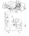 Fig. 03 - APPARATUS AND METHOD FOR RELIEVING DYSPNOEA