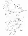 Fig. 04 - DEVICE FOR THE HINDRANCE OF SNORING AND OBSTRUCTIVE SLEEP APNEA
