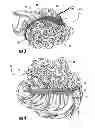 Fig. 04 - INVERTIBLE HAIRPIECE AND METHOD OF USING SAME