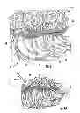Fig. 07 - INVERTIBLE HAIRPIECE AND METHOD OF USING SAME