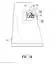 Fig. 08 - SURGICAL TOOL CLEANER AND BONE STORAGE DEVICE