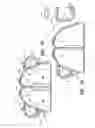 Fig. 10 - SURGICAL TOOL CLEANER AND BONE STORAGE DEVICE
