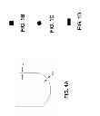 Fig. 02 - Shape setting a shape memory alloy dental arch