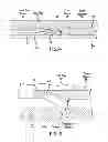 Fig. 04 - Tube locking mechanism for downhole components