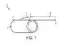 Fig. 02 - Ring device