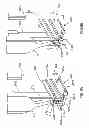Fig. 07 - Delivering bioabsorbable fasteners