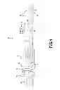 Fig. 02 - Vehicle coupling fault detecting system