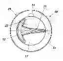 Fig. 01 - FLOW CHARACTERIZING DEVICE AND BALL VALVE WITH SUCH A FLOW CHARACTERIZING DEVICE