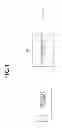 Fig. 02 - BOUNDARY LINE RECOGNITION APPARATUS