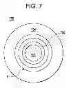 Fig. 11 - Asymmetric lens design and method for preventing and/or slowing myopia progression