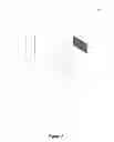 Fig. 03 - Stereovision optometry apparatus