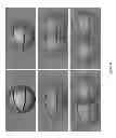 Fig. 09 - Stereovision optometry apparatus