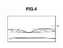 Fig. 05 - Optical coherence tomographic imaging apparatus and method of controlling the same