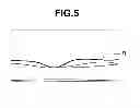 Fig. 06 - Optical coherence tomographic imaging apparatus and method of controlling the same