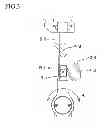 Fig. 04 - Slit lamp microscope