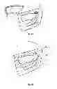 Fig. 11 - Light-emitting interior trim component for a motor vehicle