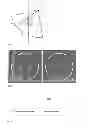 Fig. 05 - Method and apparatus for data conversion in an unequal gamma angle CT system