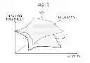 Fig. 06 - Hearing loss compensation apparatus and method using 3D equal loudness contour