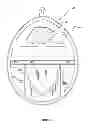 Fig. 05 - CANINE WASTE CONTAINMENT SYSTEM