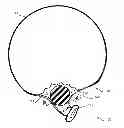 Fig. 01 - METHOD AND APPARATUS FOR SEALING A BALLOON