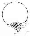 Fig. 04 - METHOD AND APPARATUS FOR SEALING A BALLOON