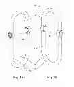Fig. 02 - Shackle assembly with locking pin