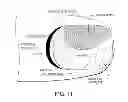 Fig. 12 - NEAR INFRARED MICROBIAL ELIMINATION LASER SYSTEMS (NIMELS)