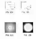 Fig. 13 - NEAR INFRARED MICROBIAL ELIMINATION LASER SYSTEMS (NIMELS)