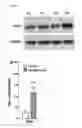 Fig. 07 - METHODS AND COMPOSITIONS FOR TREATING ATRIAL  FIBRILLATION