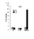 Fig. 22 - PREPARATION METHOD OF AN IMPLANT COMPRISING DRUG DELIVERY LAYER AND IMPLANT COMPOSITION FOR LIVING DONOR TRANSPLANTATION COMPRISING THE SAME