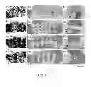 Fig. 06 - SURFACE FUNCTIONAL BIOACTIVE GLASS SCAFFOLD FOR BONE REGENERATION